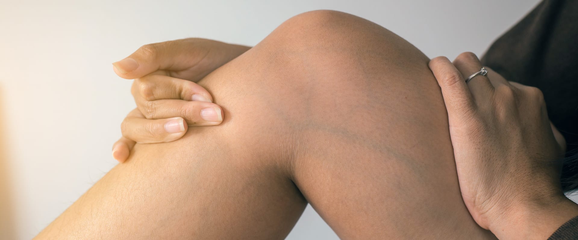 Document error resulting in unnecessary vein surgery leads to clinical negligence settlement