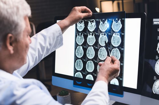 A doctor wearing a white coat examining brain scan images on a computer screen with a magnifying glass.