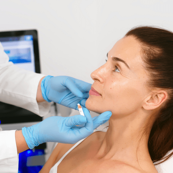 Aesthetician marks up a patient's face for treatment